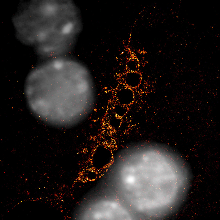Super-resolution microscopy image shows a bile canaliculus between two cells.